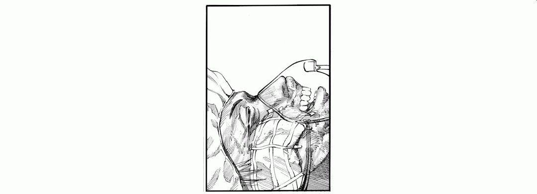 In Surgery (R) panel 6